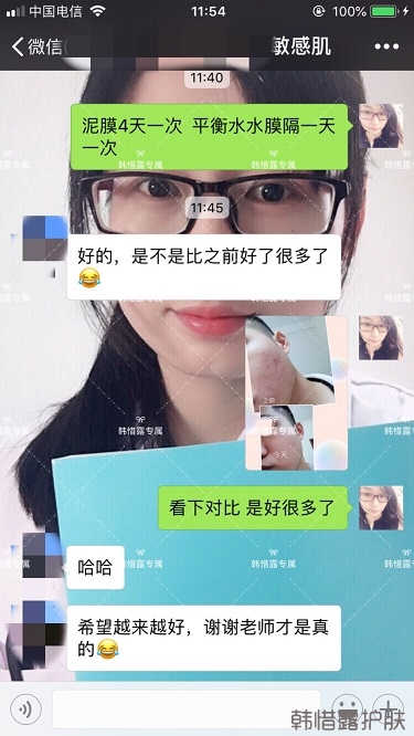 粉刺、痘痘、痘印、統(tǒng)統(tǒng)解決啦！祛痘去粉刺就是這么簡單！