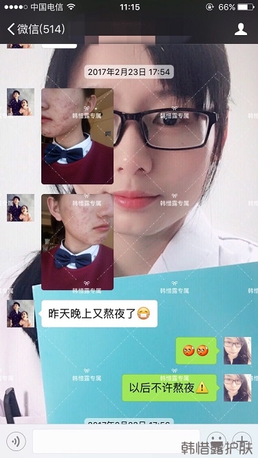 臉上長痘痘怎么去掉？徹底告別痘痘，自卑到自信的蛻變！