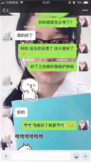 【視頻】臉上長粉刺怎樣去掉？醫院都沒搞定韓惜露幫我搞定了，超級開心！