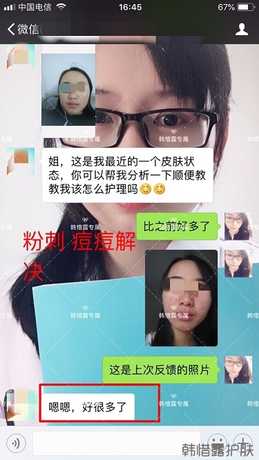 額頭長痘臉頰長痘痘粉刺，這樣調理幫你恢復嫩白肌膚！