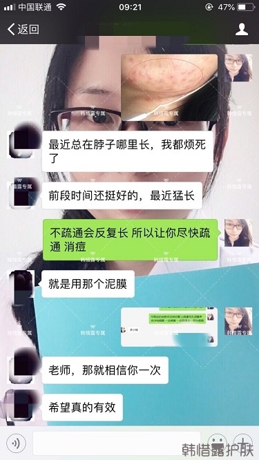 激素臉滿臉粉刺痘痘到光滑健康肌膚的蛻變