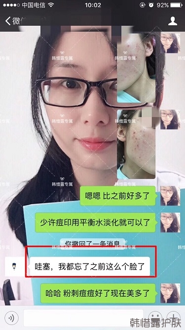 痘痘好了皮膚美麗,不想再記起曾經滿臉痘痘的自己!