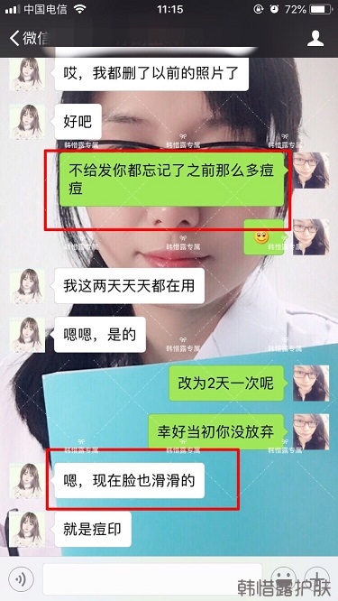 膿包痘祛痘效果，擁有干凈的臉不等待！