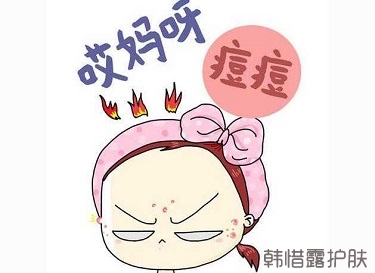 快速祛痘的方法有哪些?