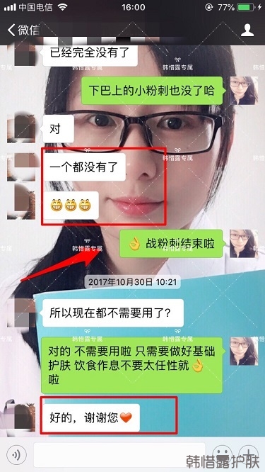 粉刺密密麻麻,試過(guò)很多方法無(wú)果后找韓惜露老師輕松去掉粉刺!