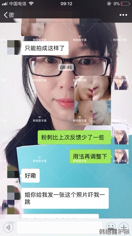 粉刺多怎么辦？按照要求配套耐心使用，粉刺消下去不少！