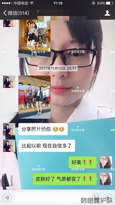 臉上長痘痘怎么去掉？徹底告別痘痘，自卑到自信的蛻變！