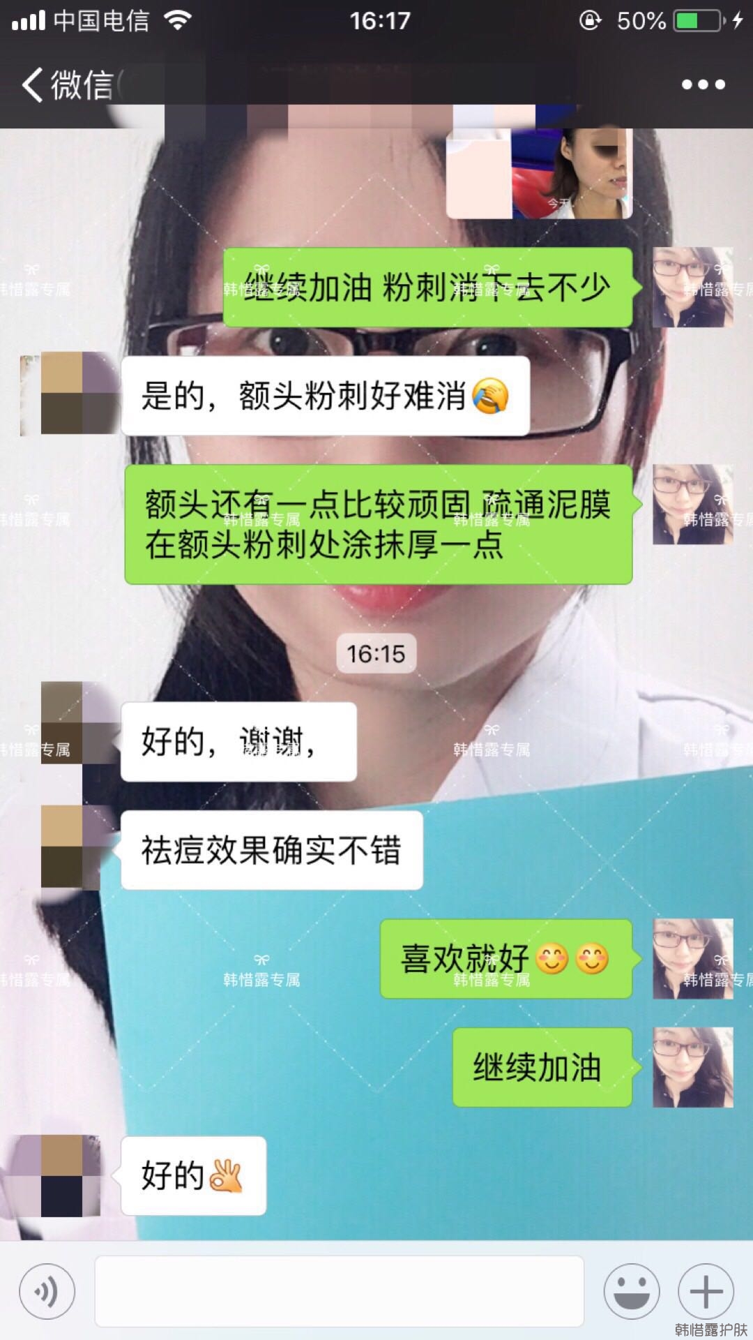 閉口粉刺怎么去除?嚴格按要求使用，粉刺效果不錯！