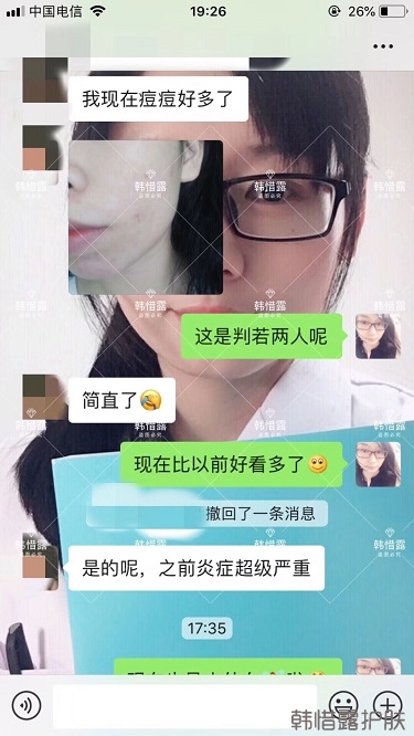 祛痘后判若兩人，膿包痘消了變小仙女