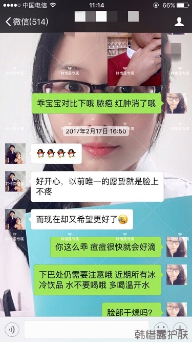 臉上長痘痘怎么去掉？徹底告別痘痘，自卑到自信的蛻變！