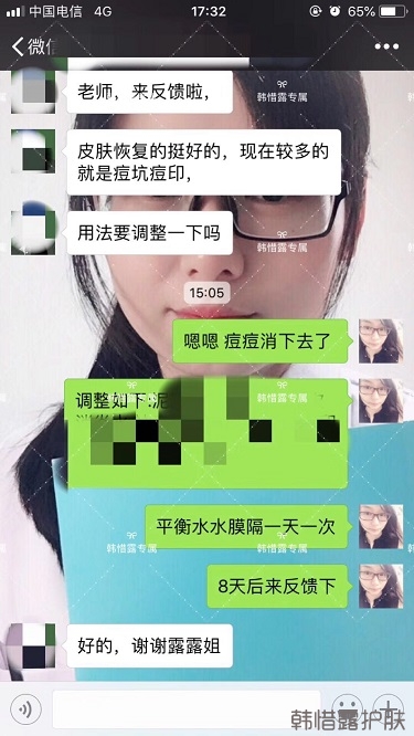 好好使用，膿包痘痘,小粉刺全消了,重點修復痘印痘坑印了