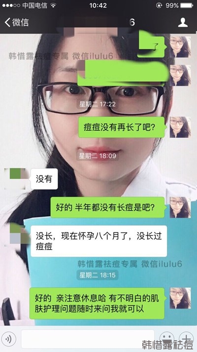 痘痘好了,再也沒有長過,懷孕8個月了!