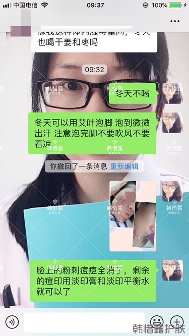 化妝品店主的變臉級祛痘反饋,粉刺痘痘全部消了