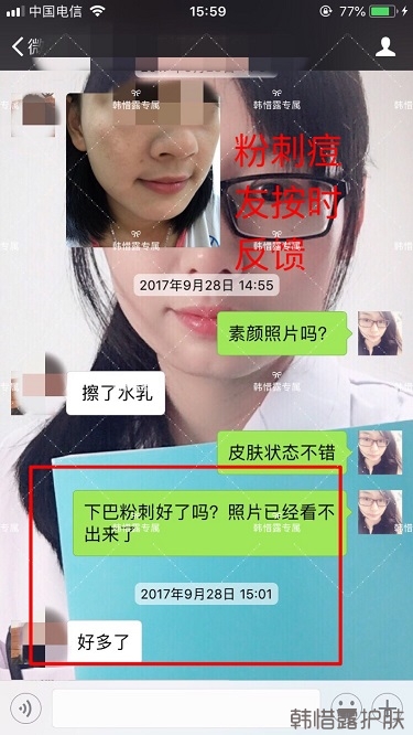 粉刺密密麻麻,試過(guò)很多方法無(wú)果后找韓惜露老師輕松去掉粉刺!