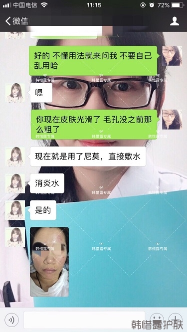 膿包痘祛痘效果，擁有干凈的臉不等待！