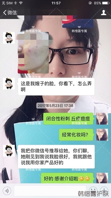 下巴長痘怎么辦？看這里徹底去掉痘痘，不再長痘了！