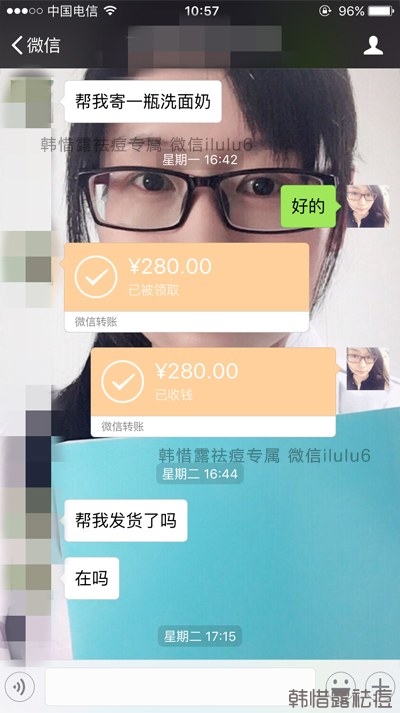 痘痘好了,再也沒有長過,懷孕8個月了!