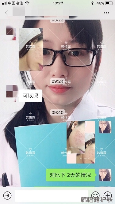 祛痘,痘痘發炎痘印就選它!