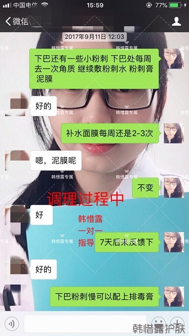 粉刺密密麻麻,試過(guò)很多方法無(wú)果后找韓惜露老師輕松去掉粉刺!