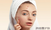 額頭長痘痘怎么調理?露露教你額頭冒痘的日常護理方法