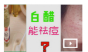 白醋可以祛痘嗎?